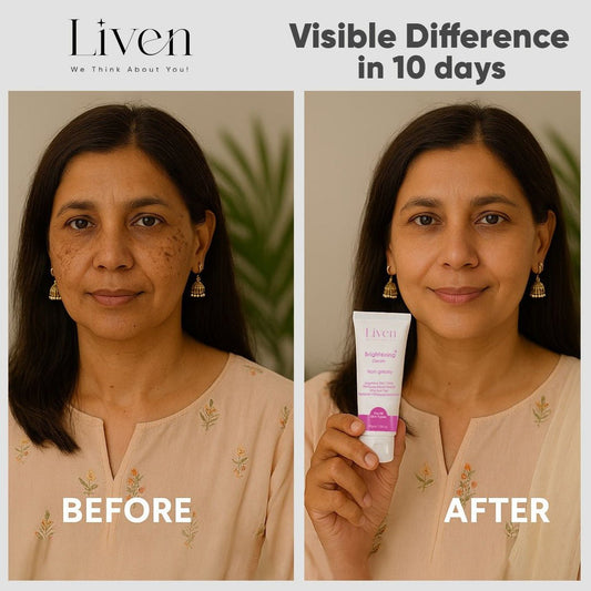 Mandelic Acid for Hyperpigmentation & Dark Spots: Your Complete Guide to Clearer Skin - Liven Skincare