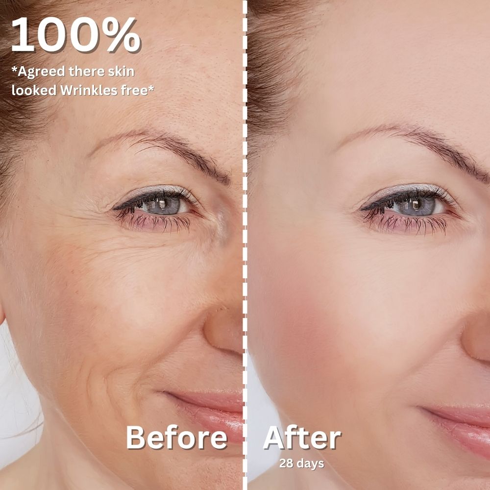 Anti Wrinkle Serum